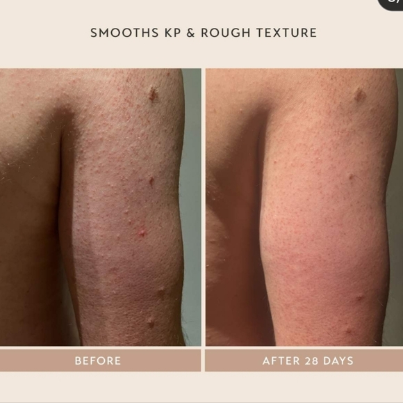 NIB SHANI DARDEN BODY REFORM TREATMENT SERUM - Picture 9 of 16